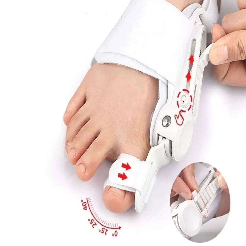 AD Ayarlanabilir Ayak Baş Parmak Kemik Düzeltici – Halluks Valgus (Bunyon) Aparatı, Gece Gündüz Kullanıma Uygun Ayak Düzeltme Ateli